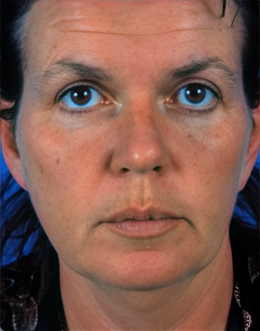beforeimg@1.2x-topaz-face-color-lighting-upscale-1x